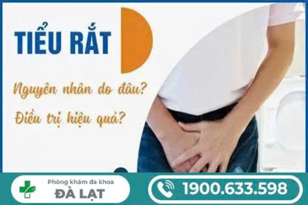 Hình ảnh minh họa